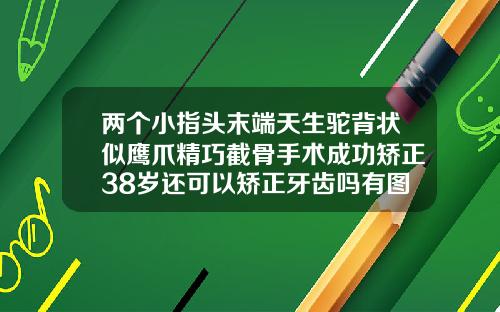 两个小指头末端天生驼背状似鹰爪精巧截骨手术成功矫正38岁还可以矫正牙齿吗有图片吗视频