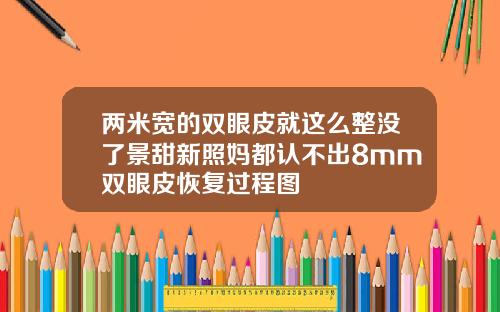 两米宽的双眼皮就这么整没了景甜新照妈都认不出8mm双眼皮恢复过程图