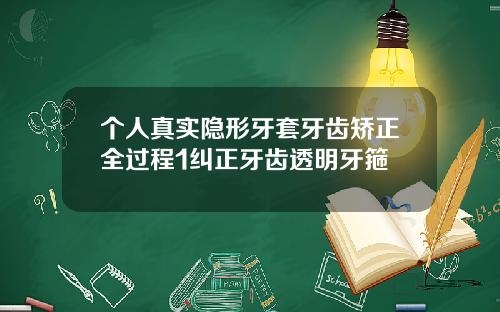 个人真实隐形牙套牙齿矫正全过程1纠正牙齿透明牙箍