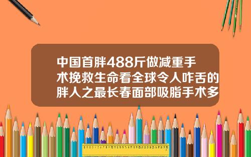 中国首胖488斤做减重手术挽救生命看全球令人咋舌的胖人之最长春面部吸脂手术多少钱