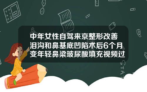 中年女性自驾来京整形改善泪沟和鼻基底凹陷术后6个月变年轻鼻梁玻尿酸填充视频过程