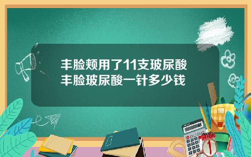 丰脸颊用了11支玻尿酸 丰脸玻尿酸一针多少钱