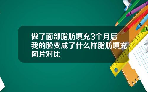做了面部脂肪填充3个月后我的脸变成了什么样脂肪填充图片对比