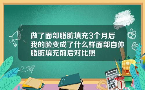做了面部脂肪填充3个月后我的脸变成了什么样面部自体脂肪填充前后对比照