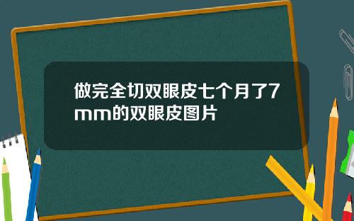 做完全切双眼皮七个月了7mm的双眼皮图片