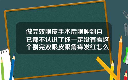 做完双眼皮手术后眼肿到自已都不认识了你一定没有看这个割完双眼皮眼角痒发红怎么回事啊