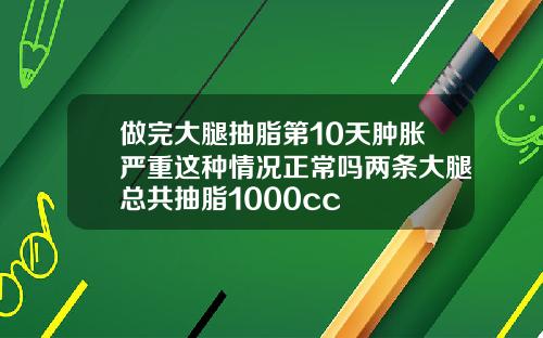 做完大腿抽脂第10天肿胀严重这种情况正常吗两条大腿总共抽脂1000cc