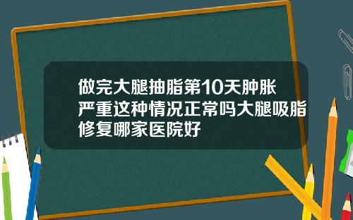 做完大腿抽脂第10天肿胀严重这种情况正常吗大腿吸脂修复哪家医院好
