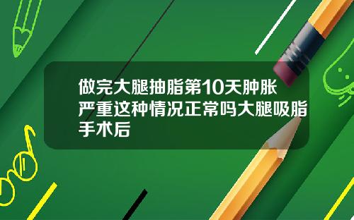 做完大腿抽脂第10天肿胀严重这种情况正常吗大腿吸脂手术后