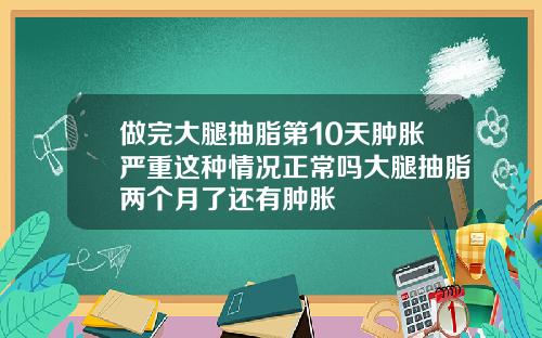 做完大腿抽脂第10天肿胀严重这种情况正常吗大腿抽脂两个月了还有肿胀