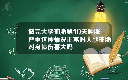 做完大腿抽脂第10天肿胀严重这种情况正常吗大腿抽脂对身体伤害大吗