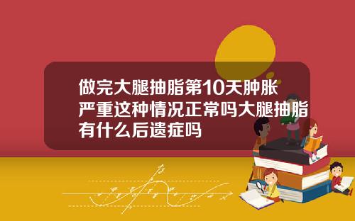 做完大腿抽脂第10天肿胀严重这种情况正常吗大腿抽脂有什么后遗症吗