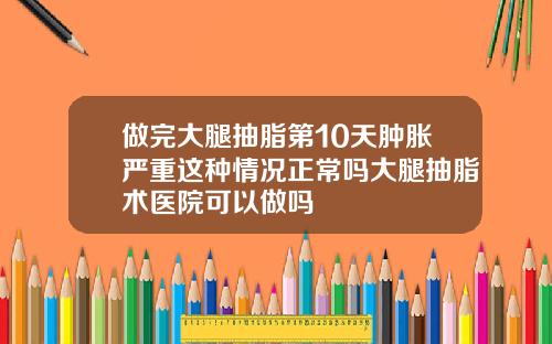 做完大腿抽脂第10天肿胀严重这种情况正常吗大腿抽脂术医院可以做吗