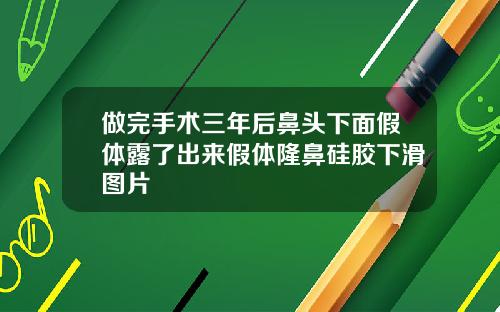 做完手术三年后鼻头下面假体露了出来假体隆鼻硅胶下滑图片