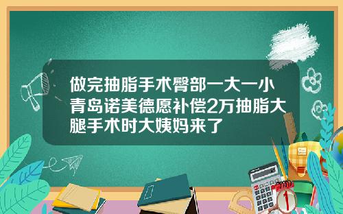做完抽脂手术臀部一大一小青岛诺美德愿补偿2万抽脂大腿手术时大姨妈来了