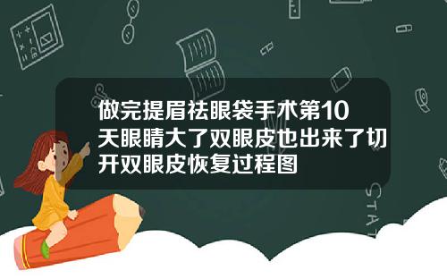 做完提眉祛眼袋手术第10天眼睛大了双眼皮也出来了切开双眼皮恢复过程图