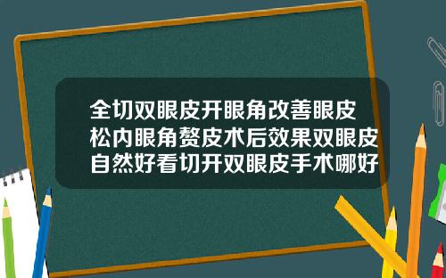 全切双眼皮开眼角改善眼皮松内眼角赘皮术后效果双眼皮自然好看切开双眼皮手术哪好