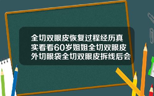 全切双眼皮恢复过程经历真实看看60岁姐姐全切双眼皮外切眼袋全切双眼皮拆线后会有变化吗