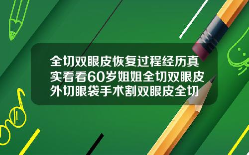 全切双眼皮恢复过程经历真实看看60岁姐姐全切双眼皮外切眼袋手术割双眼皮全切