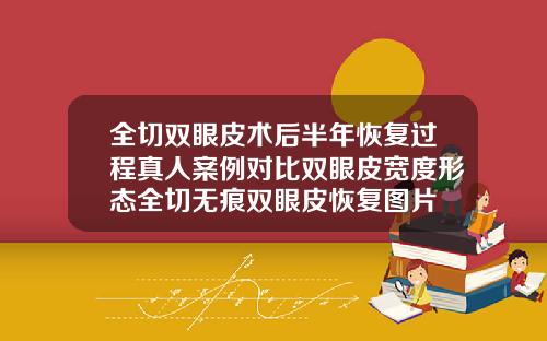 全切双眼皮术后半年恢复过程真人案例对比双眼皮宽度形态全切无痕双眼皮恢复图片
