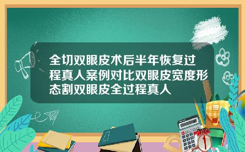 全切双眼皮术后半年恢复过程真人案例对比双眼皮宽度形态割双眼皮全过程真人