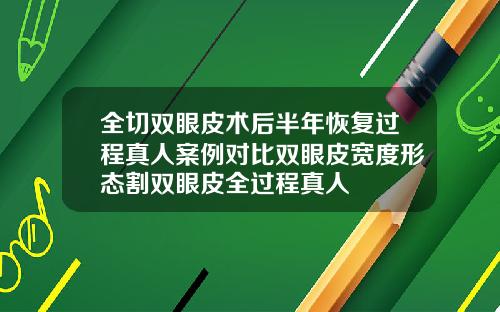 全切双眼皮术后半年恢复过程真人案例对比双眼皮宽度形态割双眼皮全过程真人