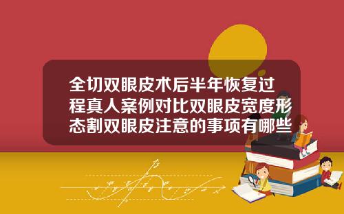 全切双眼皮术后半年恢复过程真人案例对比双眼皮宽度形态割双眼皮注意的事项有哪些图片