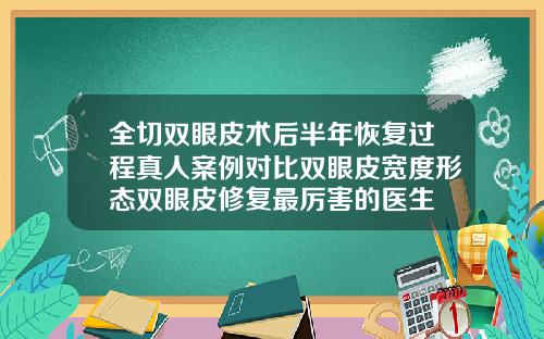 全切双眼皮术后半年恢复过程真人案例对比双眼皮宽度形态双眼皮修复最厉害的医生