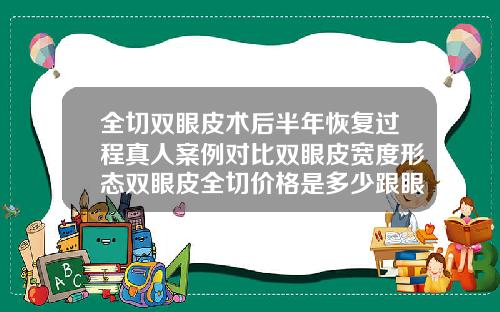 全切双眼皮术后半年恢复过程真人案例对比双眼皮宽度形态双眼皮全切价格是多少跟眼综合有什么区别