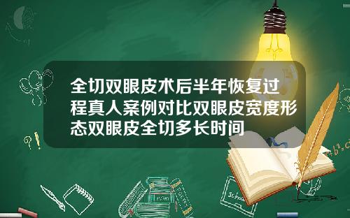 全切双眼皮术后半年恢复过程真人案例对比双眼皮宽度形态双眼皮全切多长时间