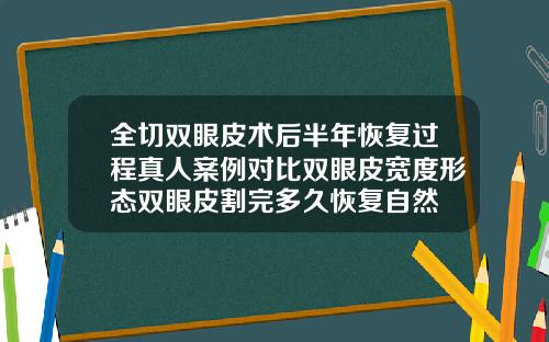 全切双眼皮术后半年恢复过程真人案例对比双眼皮宽度形态双眼皮割完多久恢复自然