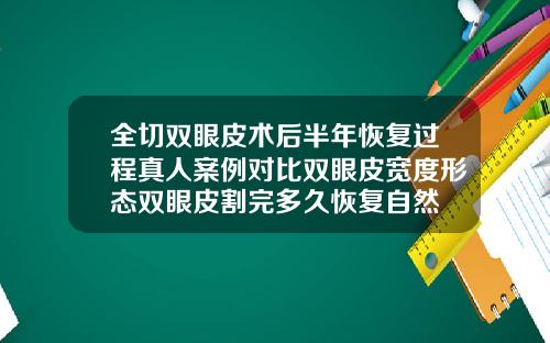 全切双眼皮术后半年恢复过程真人案例对比双眼皮宽度形态双眼皮割完多久恢复自然