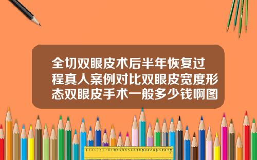 全切双眼皮术后半年恢复过程真人案例对比双眼皮宽度形态双眼皮手术一般多少钱啊图片