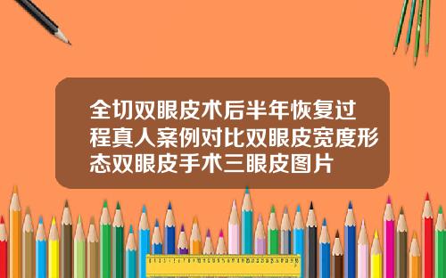 全切双眼皮术后半年恢复过程真人案例对比双眼皮宽度形态双眼皮手术三眼皮图片