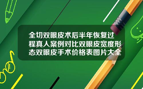 全切双眼皮术后半年恢复过程真人案例对比双眼皮宽度形态双眼皮手术价格表图片大全