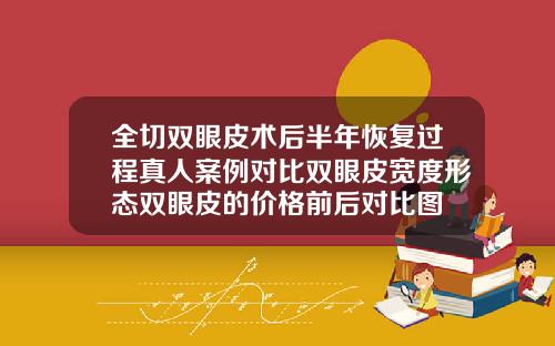 全切双眼皮术后半年恢复过程真人案例对比双眼皮宽度形态双眼皮的价格前后对比图