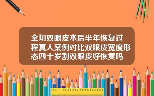 全切双眼皮术后半年恢复过程真人案例对比双眼皮宽度形态四十岁割双眼皮好恢复吗