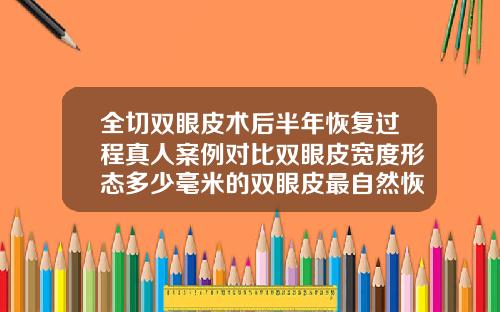 全切双眼皮术后半年恢复过程真人案例对比双眼皮宽度形态多少毫米的双眼皮最自然恢复