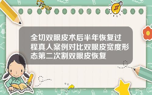 全切双眼皮术后半年恢复过程真人案例对比双眼皮宽度形态第二次割双眼皮恢复