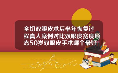 全切双眼皮术后半年恢复过程真人案例对比双眼皮宽度形态50岁双眼皮手术哪个最好做