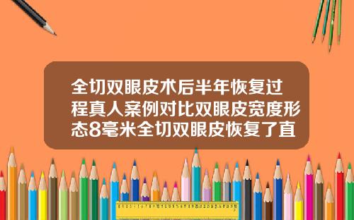 全切双眼皮术后半年恢复过程真人案例对比双眼皮宽度形态8毫米全切双眼皮恢复了直观多宽