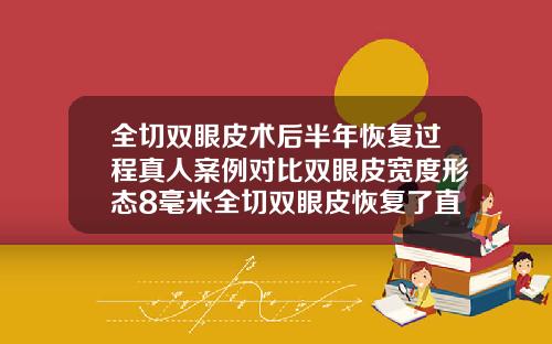 全切双眼皮术后半年恢复过程真人案例对比双眼皮宽度形态8毫米全切双眼皮恢复了直观多宽
