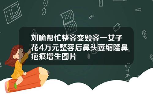 刘喻帮忙整容变毁容一女子花4万元整容后鼻头萎缩隆鼻疤痕增生图片