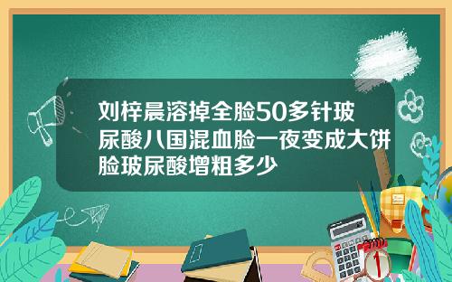 刘梓晨溶掉全脸50多针玻尿酸八国混血脸一夜变成大饼脸玻尿酸增粗多少