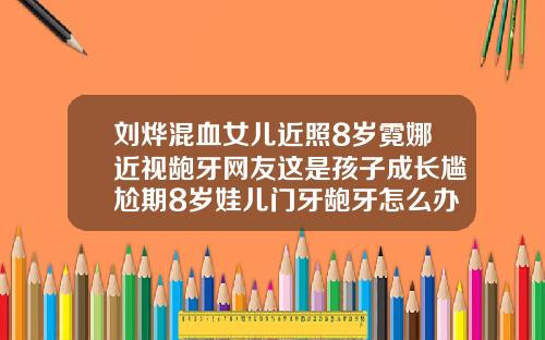 刘烨混血女儿近照8岁霓娜近视龅牙网友这是孩子成长尴尬期8岁娃儿门牙龅牙怎么办