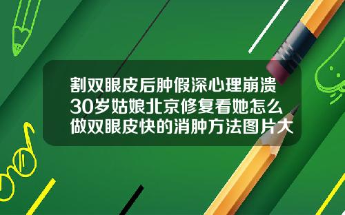 割双眼皮后肿假深心理崩溃30岁姑娘北京修复看她怎么做双眼皮快的消肿方法图片大全