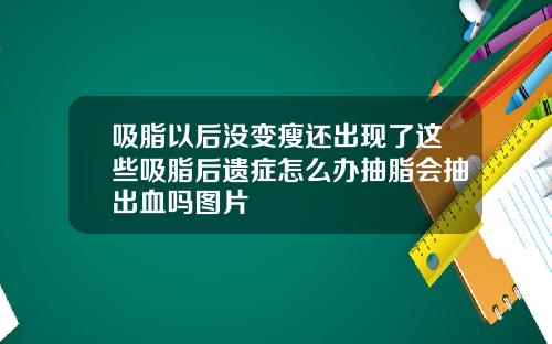吸脂以后没变瘦还出现了这些吸脂后遗症怎么办抽脂会抽出血吗图片