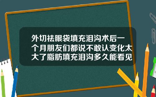 外切祛眼袋填充泪沟术后一个月朋友们都说不敢认变化太大了脂肪填充泪沟多久能看见完全效果