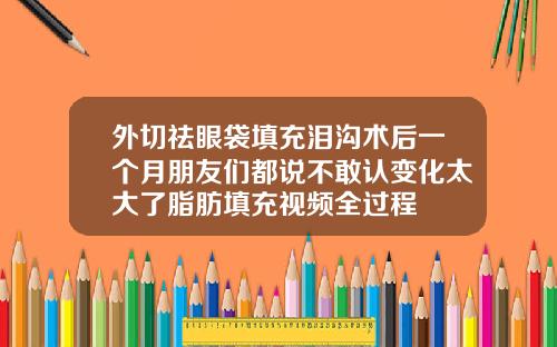 外切祛眼袋填充泪沟术后一个月朋友们都说不敢认变化太大了脂肪填充视频全过程
