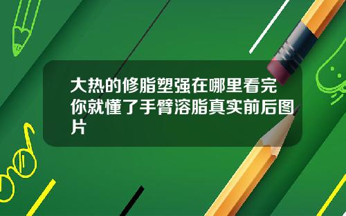 大热的修脂塑强在哪里看完你就懂了手臂溶脂真实前后图片